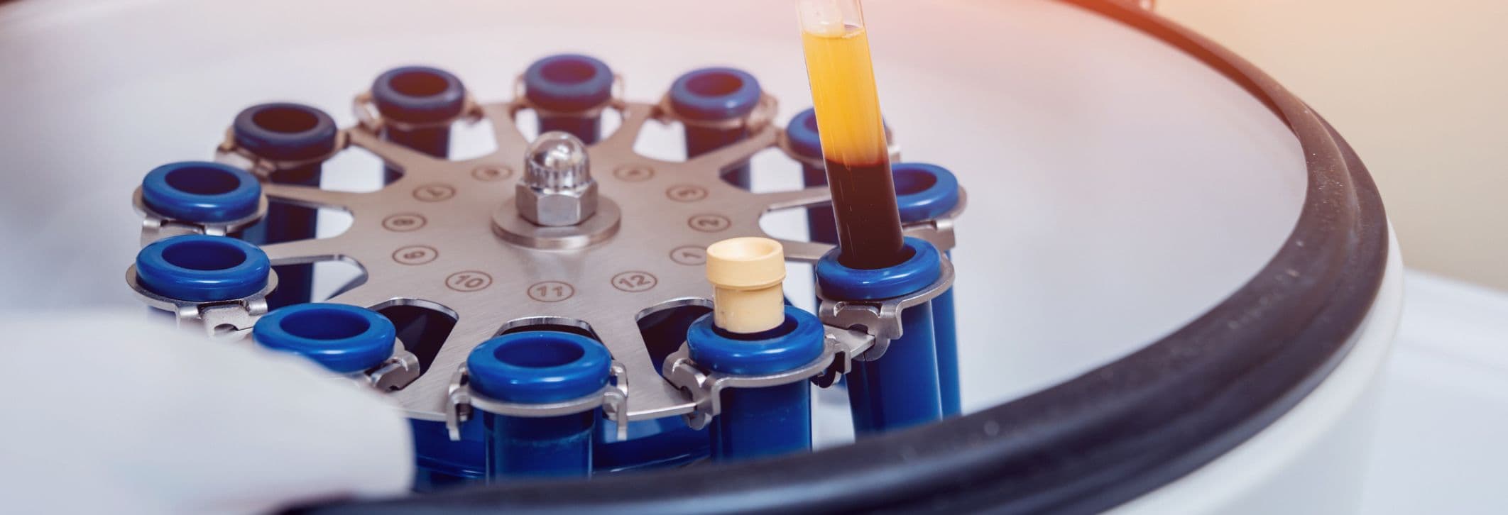 PRF zur Gesichtsverjüngung bei artethic® Düsseldorf