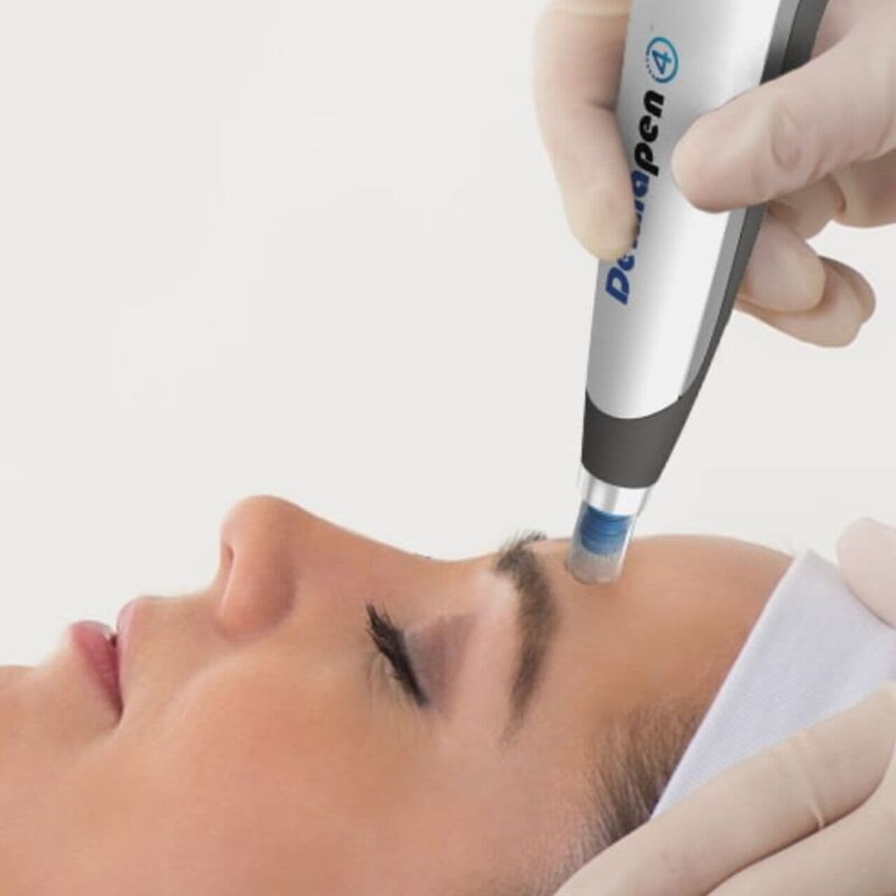 PRP + Microneedling