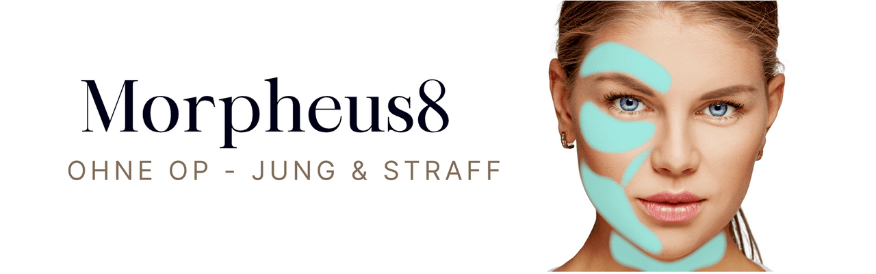 Morpheus 8 Radiofrequenz Microneedling Düsseldorf