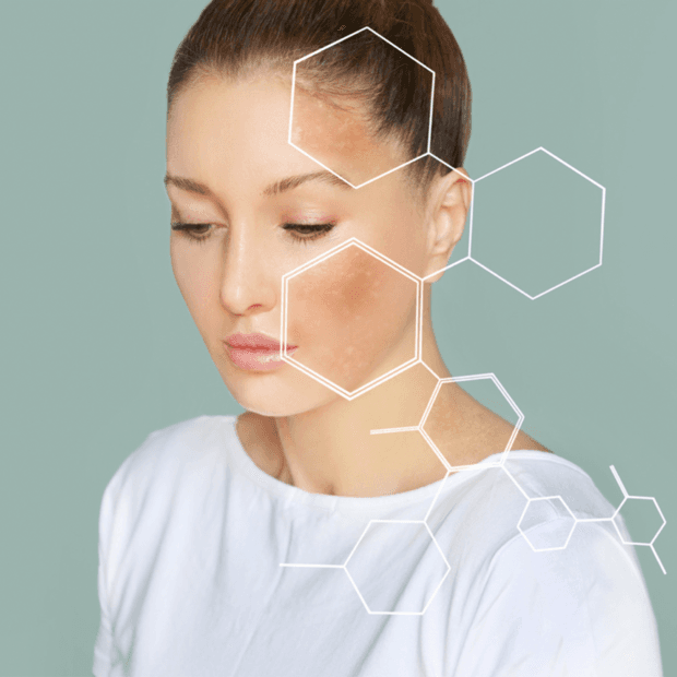 HydraFacial Kosten Düsseldorf