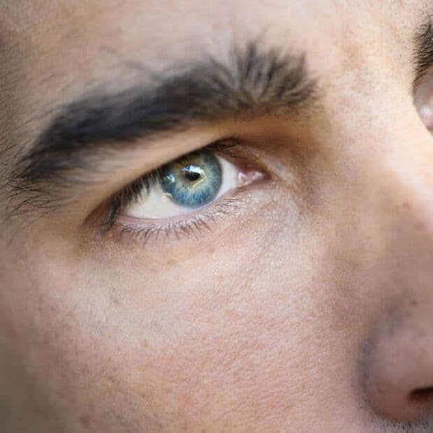 Lidstraffung Düsseldorf | Mann | Dr. Schuhmann