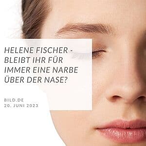 Bleibt ihr für immer eine Narbe über der Nase?