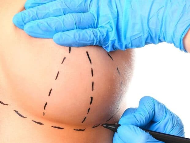 Brustchirurgie: Vergrößerung, Verkleinerung, Rekonstruktion