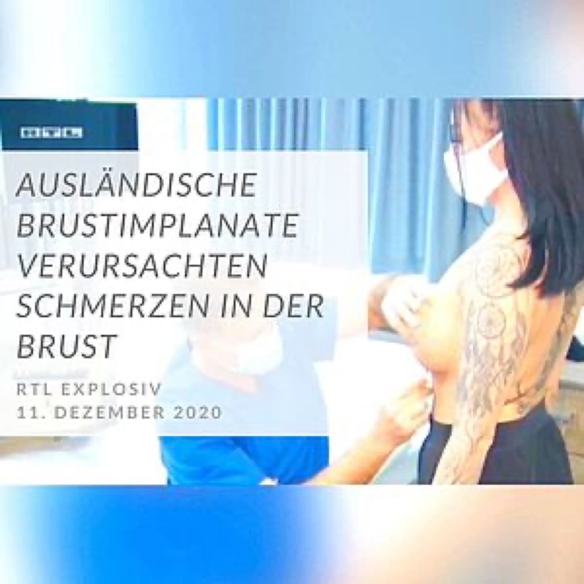 Brustimplantate wechseln