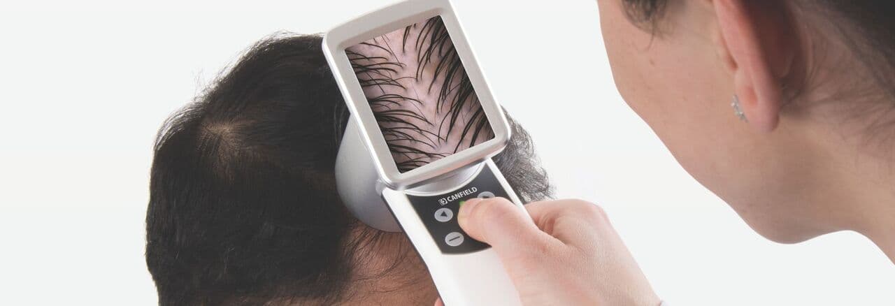 Polynukleotide gegen Haarausfall