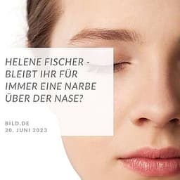 Bleibt ihr für immer eine Narbe über der Nase?