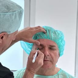 Tim Toupet Augenlidstraffung in unserer Plastischen Chirurgie in Düsseldorf