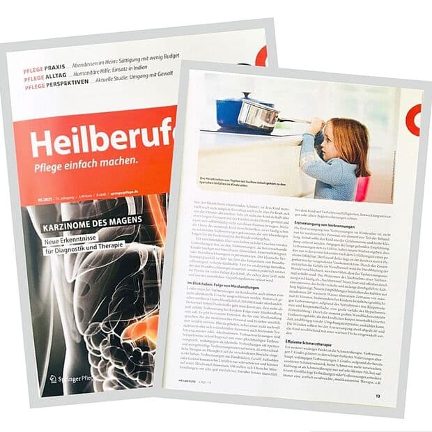 Verbrennungen bei Kindern und Jugendlichen