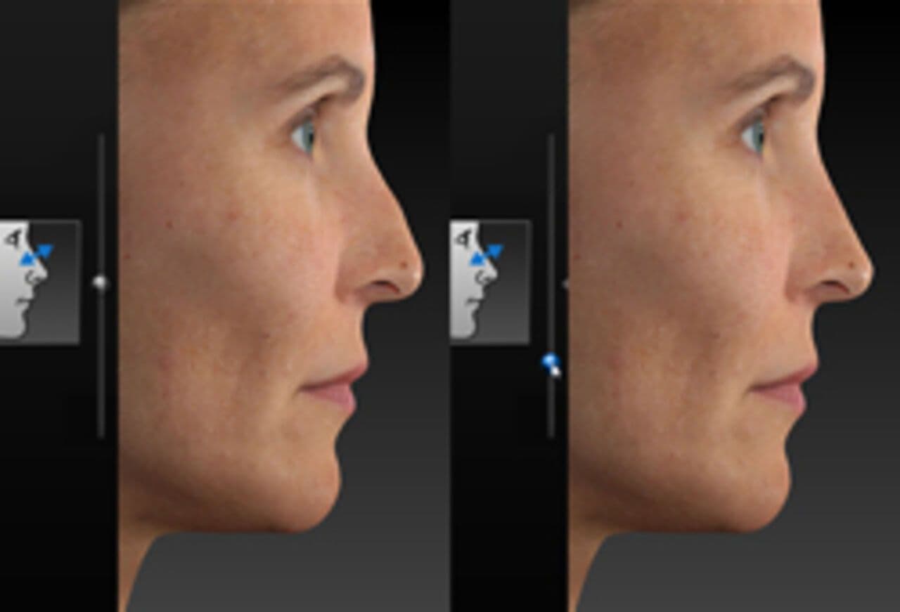 Face Sculptor – 3D-Simulation Gesicht