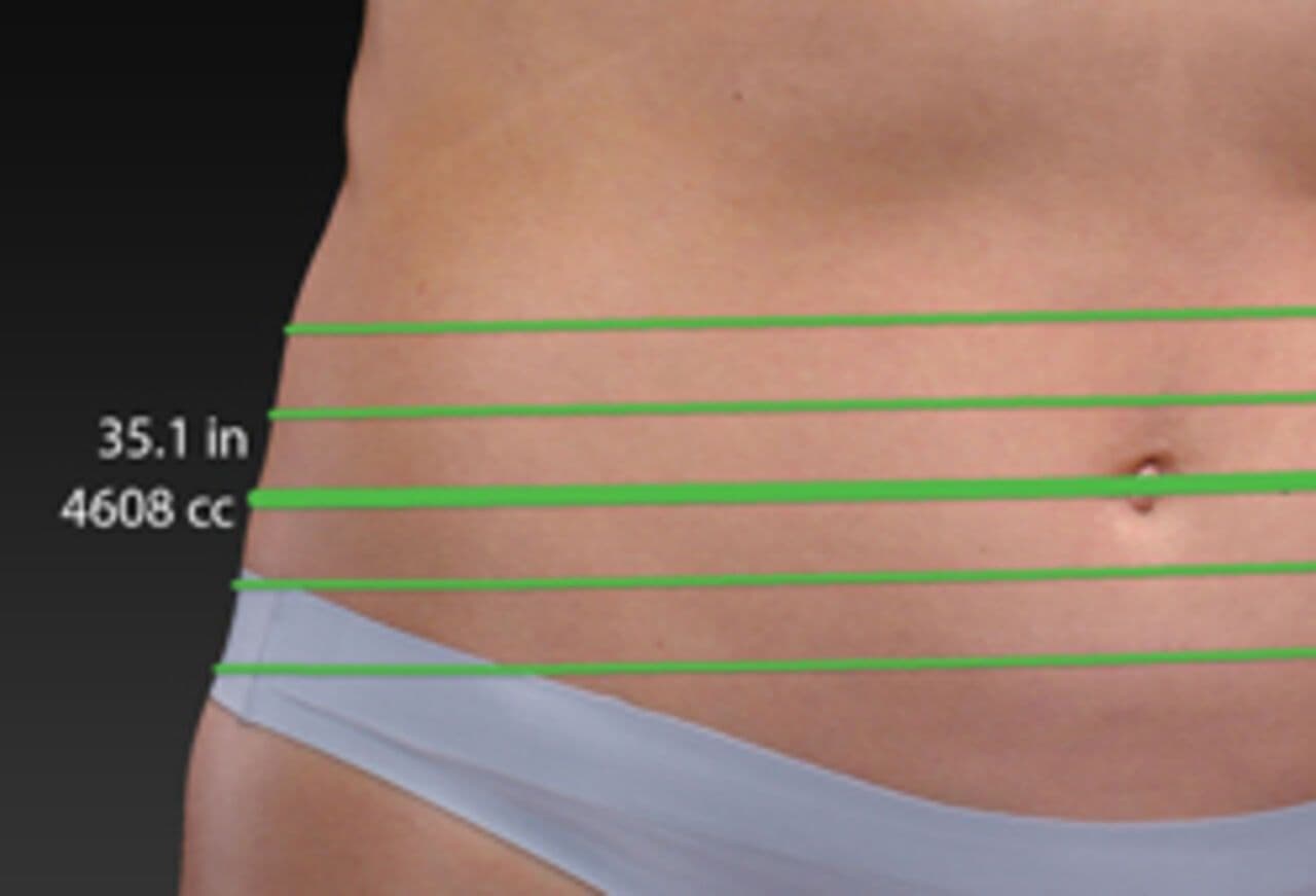 Body Sculptor – 3D-Simulation Körper