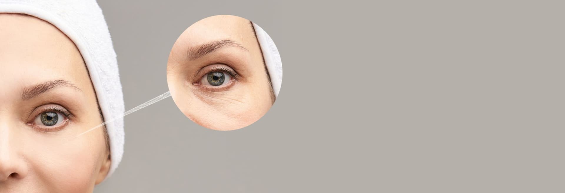 Kein Filler unter den Augen – artethic® Düsseldorf
