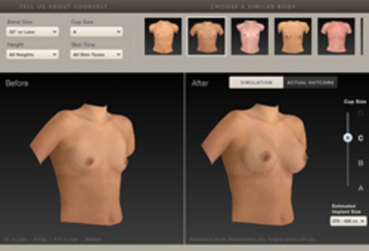 Breast Sculptor – 3D-Simulation Brust